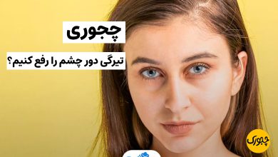 چجوری تیرگی دور چشم را رفع کنیم؟