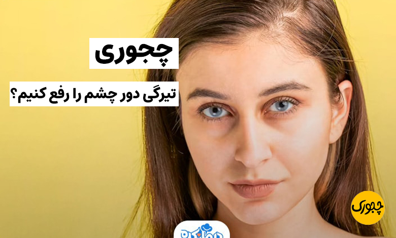 چجوری تیرگی دور چشم را رفع کنیم؟